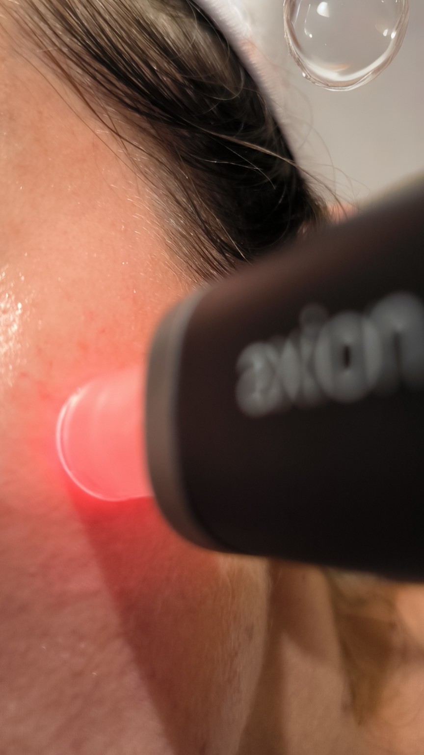 Soin AXION Mesoestetic avec lumière LED rouge chez Lady Beauty à Nice